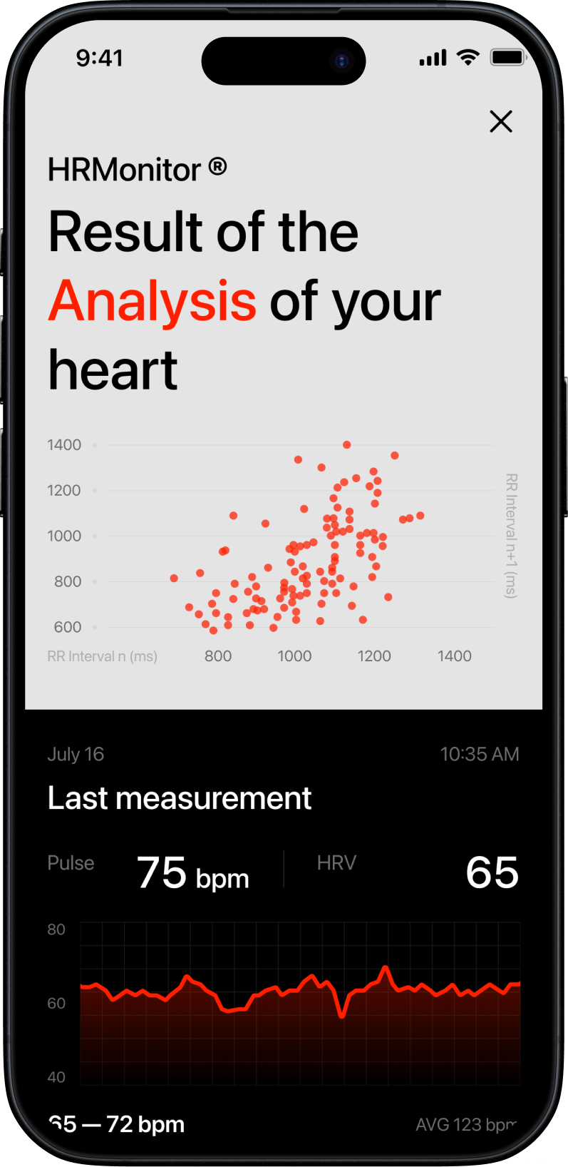 Result — analysis of your heart (HR & HRV)
